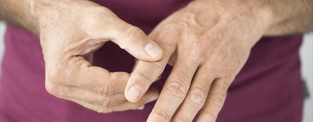 Close up of elderly mans hands while he is grasping his pointer finger on the lefthand using the thumb and pointer finger on the right indicating pain in the joint.